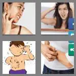 4 pics 1 word 5 letters itchy