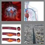 4 pics 1 word 6 letters artery