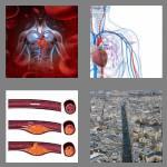 4 pics 1 word 6 letters artery